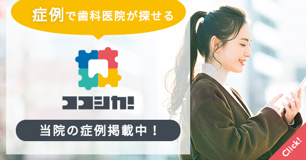 ココシカ